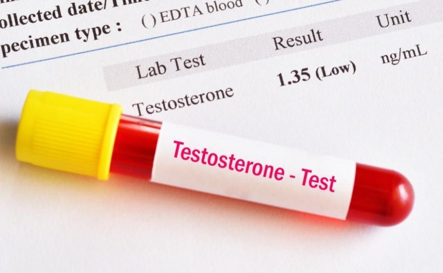 YOUR TESTOSTERONE LEVELS MAY DECREASE