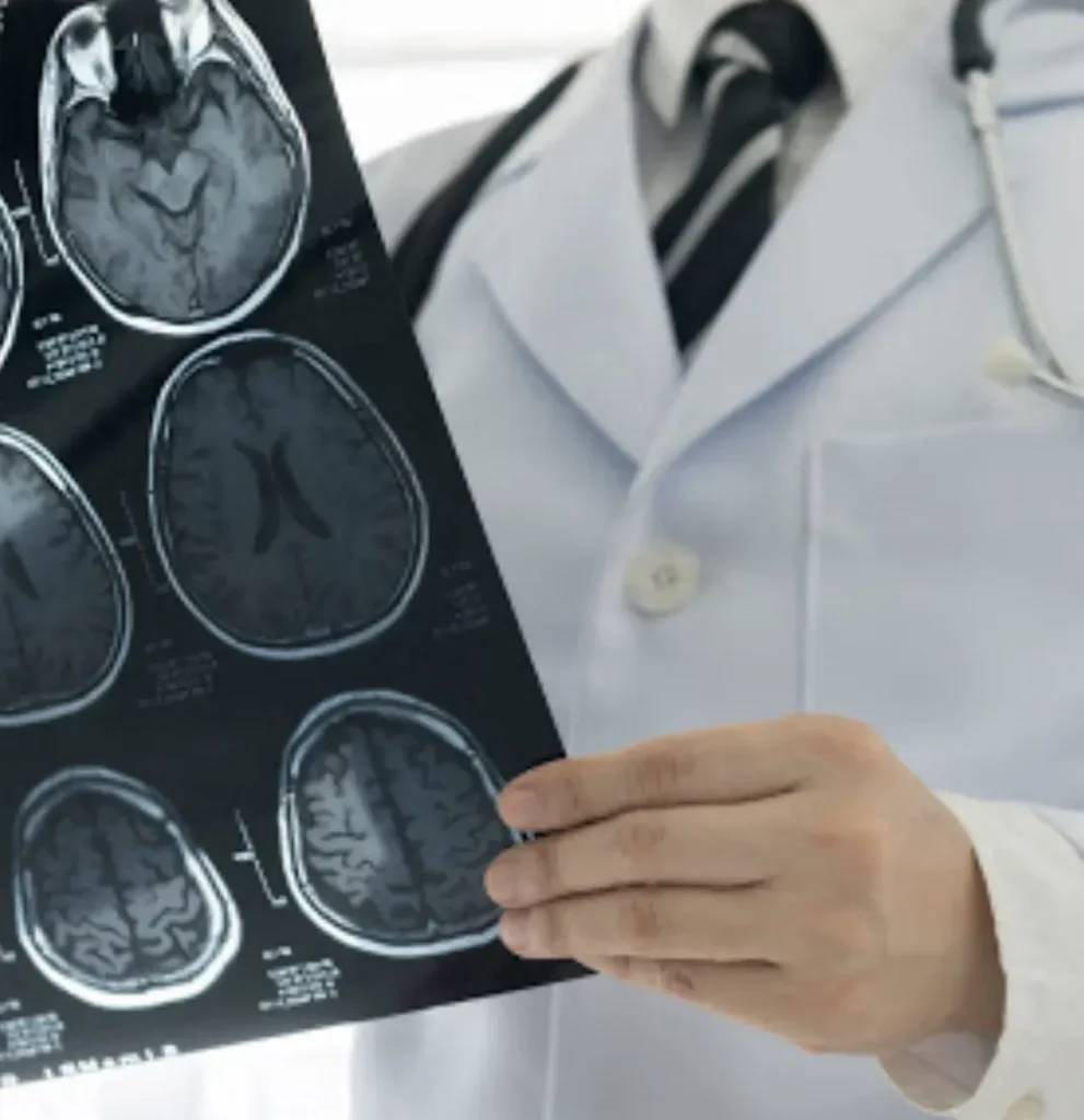 A doctor in a white coat and stethoscope holds and examines brain MRI scan images, showing various cross-sectional views of the brain.