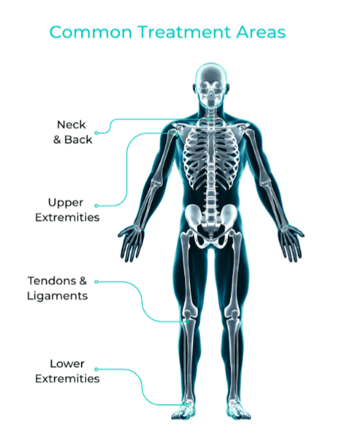 Diagram of a human skeleton highlighting common treatment areas: neck & back, upper extremities (arms), tendons & ligaments (knees and ankles), and lower extremities (legs and feet). Labels point to each area.