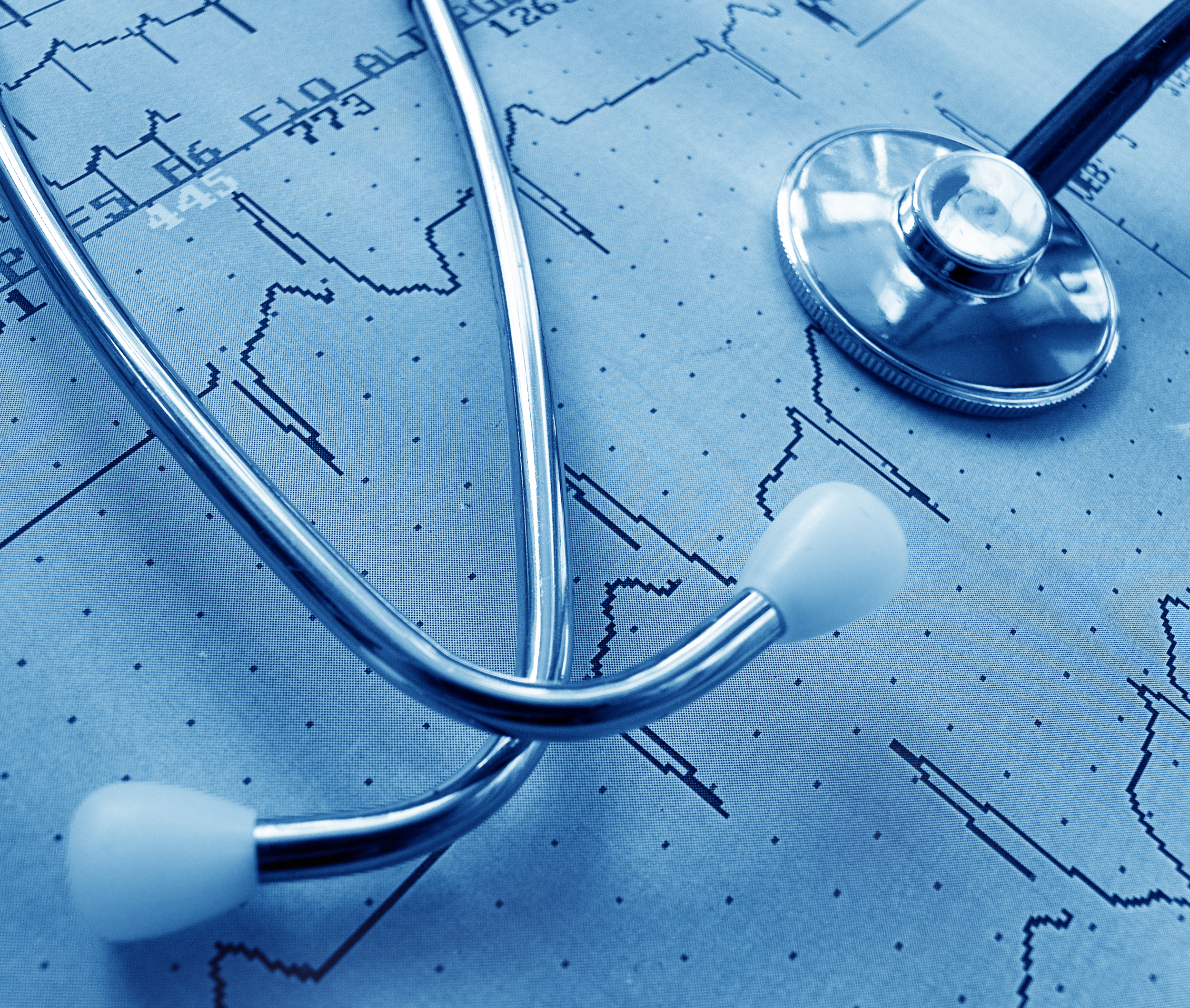 A stethoscope rests on top of an electrocardiogram (ECG/EKG) printout, showing heart rate patterns in blue tones, symbolizing medical diagnostics and healthcare.