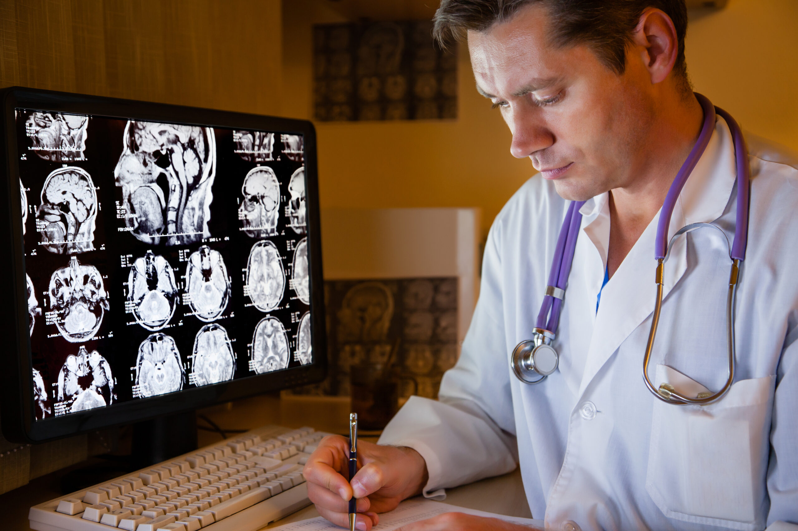 A doctor in a white coat reviews brain scan images displayed on a computer screen while writing notes at a desk, with a stethoscope hanging around his neck.