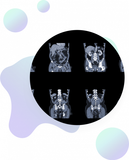 A circular collage of six grayscale medical scans, likely CT or MRI images of the abdomen and pelvis, displayed on a black background with abstract pastel shapes in the corners.