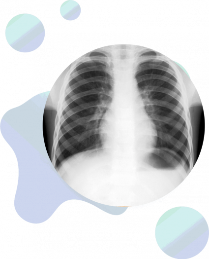 Close up of a chest X ray.